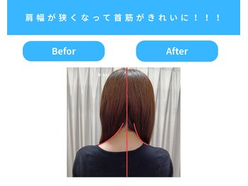 きくち整骨院/首筋がきれいに