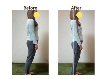 フェルナ(FERNA)/Before/After