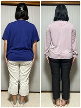 ベルネージュ(Belle Neige)/【耳つぼ】50代4ヶ月-8.8kg