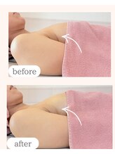 ワム(Wom)/40代/潤いと質感変化でしわ予防