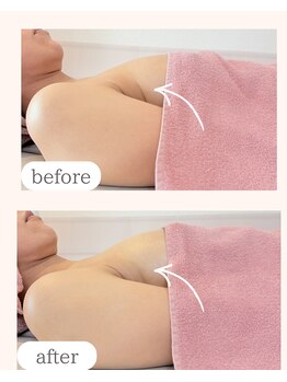 ワム(Wom)/40代/潤いと質感変化でしわ予防