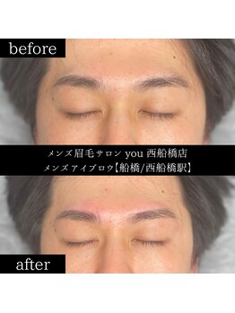 ユー 西船橋店(you)/ビフォーアフター写真