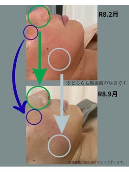 アンドスロウ(&slow)の写真/一人一人のお肌悩みに合わせて美肌作りをサポート♪【たるみケア/しみシワ改善/ニキビケア/乾燥/毛穴開き】