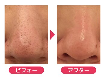 白ねこ化粧品店/こんな毛穴レスな肌も叶います♪