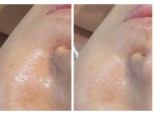 ソラ(sora)/クリスティーナ