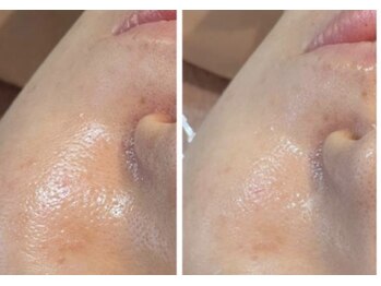 ソラ(sora)/クリスティーナ