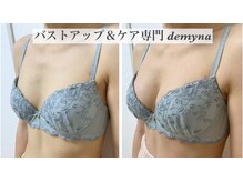 デミーナ(Demyna)/【バストアップ】症例 育乳