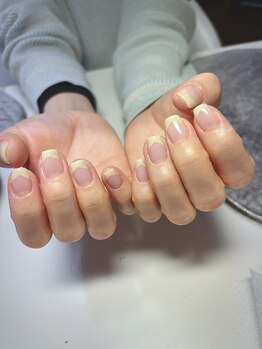 ネイルサロン デンティ(Dentty)/遊びゴコロ 幸せyellow