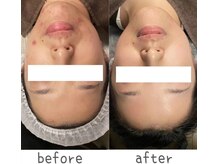 トモズサロン28(Tomos.salon.)/肌荒れ改善！敏感肌にも◎