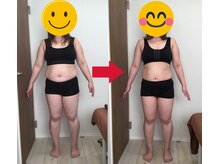 美容整体院元 光の森店/C.O様のビフォーアフター