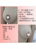 ローマピンク/乳輪/40％offモニター無料特典付/10名限定/¥220,000→¥132,000