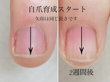 トゥインクリーネイルサロン(Twinkly Nail Salon)/【最強のネイルケア】1回お試し