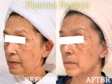 レイネ(REINE)/ファーマリジェネ/美肌三大要素