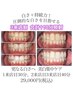 【3来店制】黄ばみを落として更なる白さ+持続力！圧倒的な白さを目指せる！！