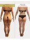 サロン ド モナ(salon de mona)の写真/【下半身セルライトケア】30代からの本気の美脚集中プログラム！浮腫み、セルライトケアで美脚づくり★