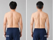 ミネルバ(MINERVA)/【施術例】　40代男性　痩身
