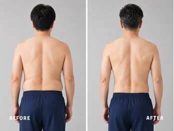 ミネルバ(MINERVA)/【施術例】 40代男性 痩身