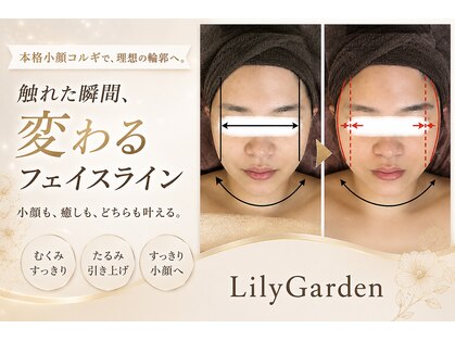リリーガーデン 手稲店(Lily Garden)の写真