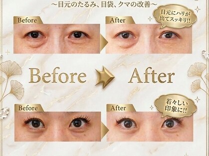 エヴァーグレース プレミシャス 心斎橋店(EVER GARACE Premycious)の写真