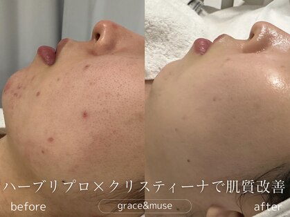 グレイス アンド ミューズ(grace&muse)の写真