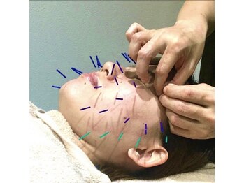 高田馬場名倉堂鍼灸接骨院/美容鍼