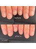 【handネイルケア・女性専用】保湿オイル付き♪お悩み解消！本気のネイルケア