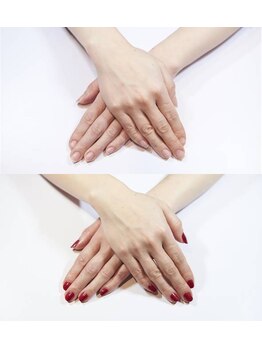 オングレース 阪急17番街店/手のエイジングケア+ジェル