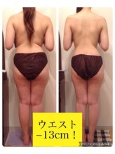 リブラザバランス(LIBRA the balance)/12回（1～2週間隔で）