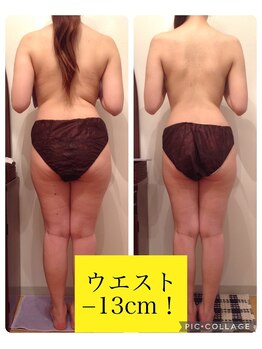 リブラザバランス(LIBRA the balance)/12回(1~2週間隔で)