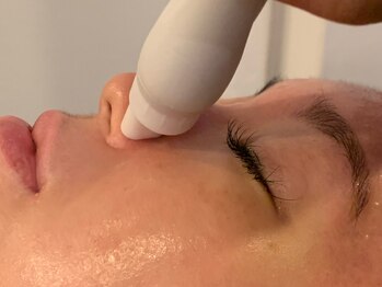 ダブル ザ サロン(W the salon)の写真/お水が生み出す美の力！毛穴洗浄と小顔効果で、敏感肌にも優しいハイドロフェイシャルを体験しよう♪