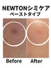 【一度で大変化!!最強シミケア】１回でポロリ！１箇所4400円（1cm×1cm）以内