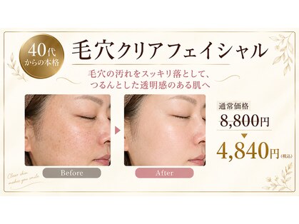 エステティックサロン ライブ井藤の写真