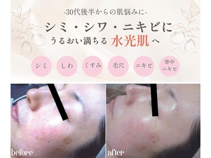 エテル(eter)の写真