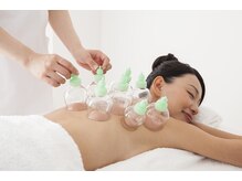 リラクゼーションサロン養舒閣/カッピング