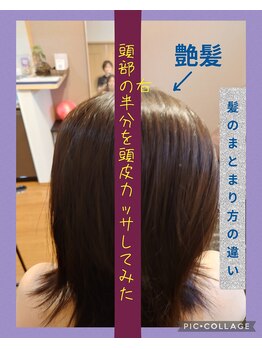 リベラ(LIBERA)/頭皮カッサ