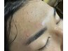 【垢抜け】眉・肌の悩み丸ごと解決　メンズフェイシャル+眉ワックス