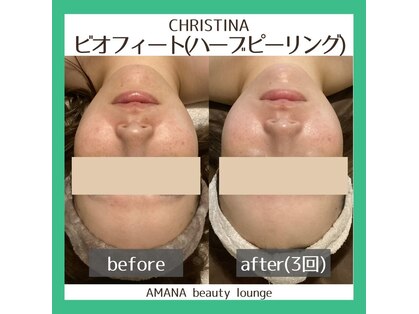 アマナ(AMANA)の写真