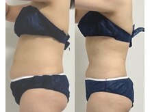 プリマルーチェ/プレミアム中心部プログラム