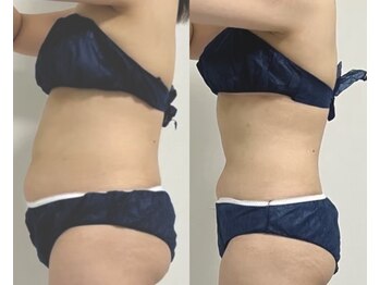 プリマルーチェ/プレミアム中心部プログラム