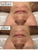 リープ(Lieb)/リアボーテ、目黒フェイシャル