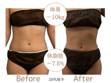 エクレ(eclat)の雰囲気（キャビゼロでー10kg☆食事制限なし！半年でこんなにサイズダウン）