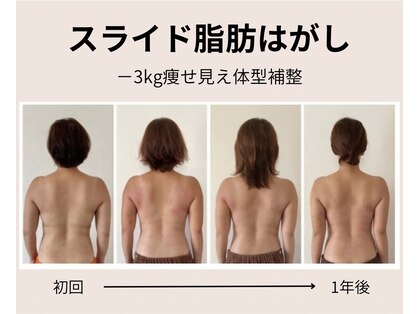 ナツコ 福島(natsuko)の写真