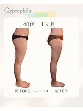 ジプソフィラ(Gypsophila)/痩身ビフォーアフター