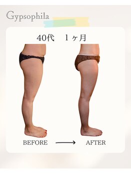 ジプソフィラ(Gypsophila)/痩身ビフォーアフター