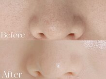 ウィハナ(wehana)