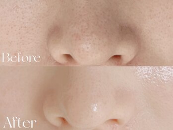 ウィハナ(wehana)