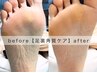 ツルツル足裏に♪【 足裏角質 】スクラブでケア◎魚の目も◎初回爪切り無料