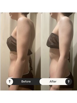 カルナ(CARNA)/ブライダル1day集中コース