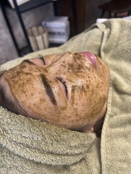 ラダ(RADA)/ハーブピーリング/シミ/ニキビ