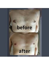 ビー ファクトリー(B FACTORY)/メンズ　胸元　ワックス